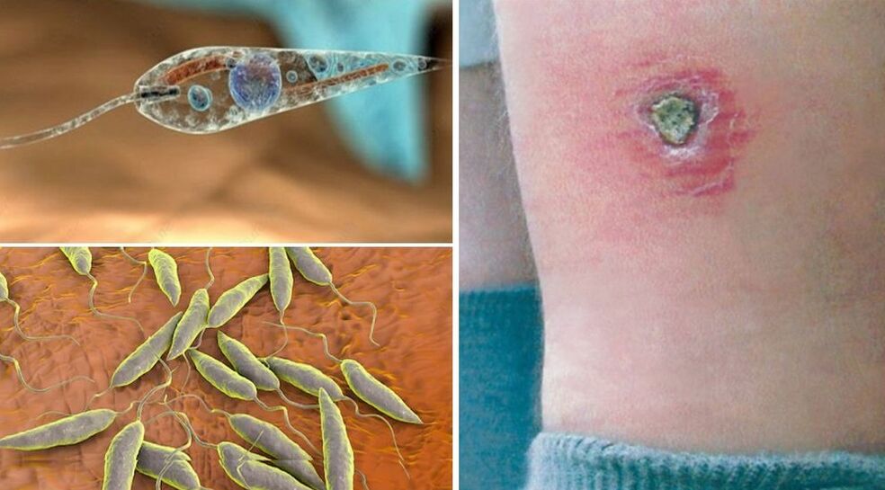 Leishmania parasita protozoário humano