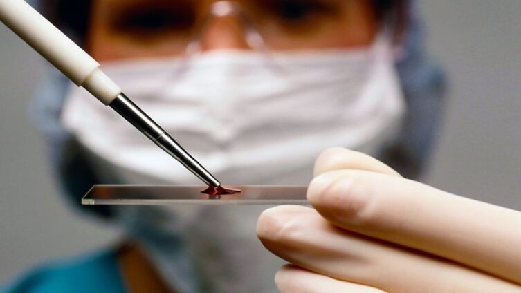 Exame de sangue