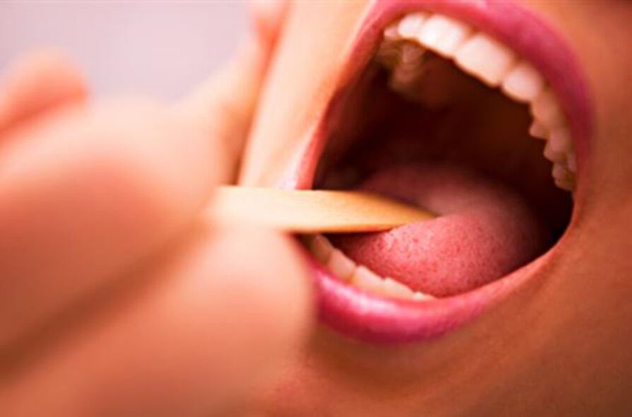 tipos de parasitas na boca humana